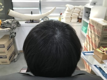 보강전
