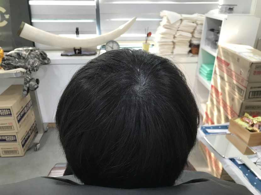 보강전