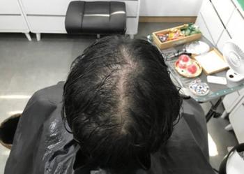 문신 전