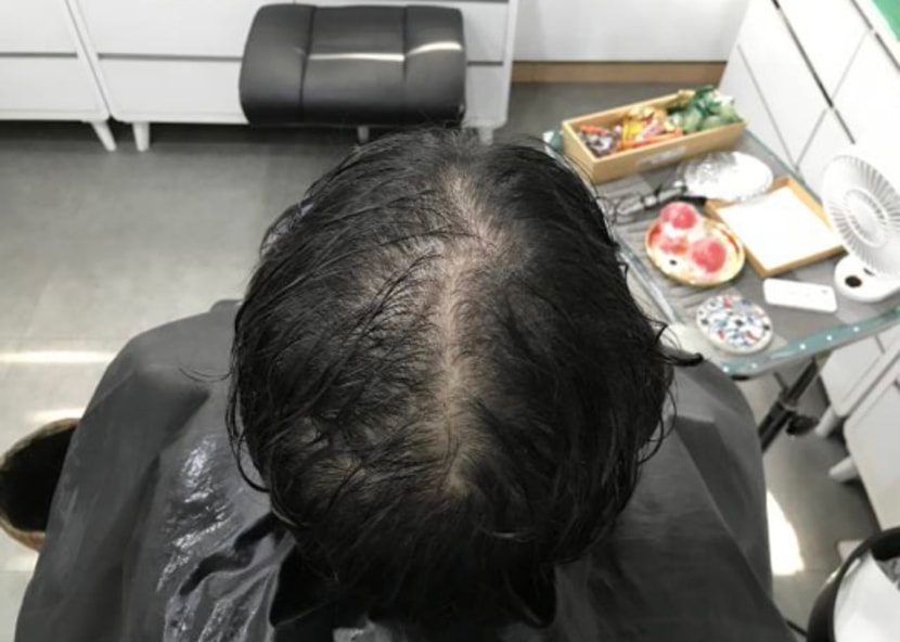 문신 전