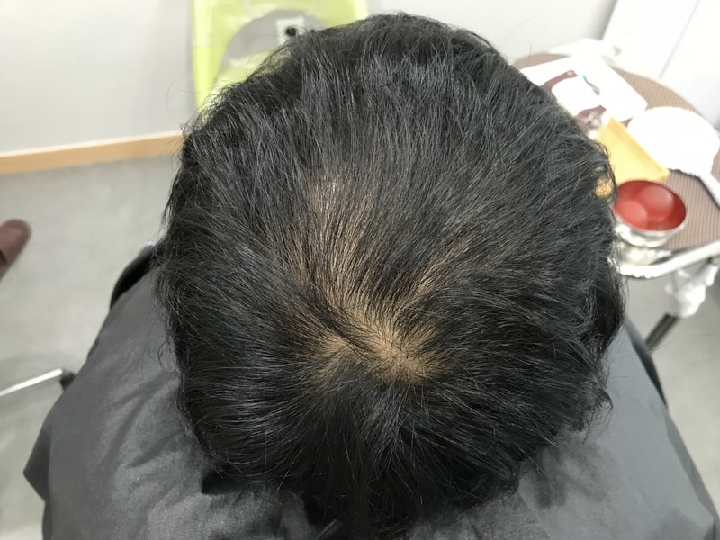 후기입니다
