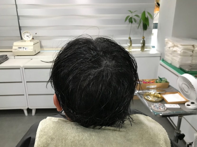&lt;시술후_젖은상태1&gt;