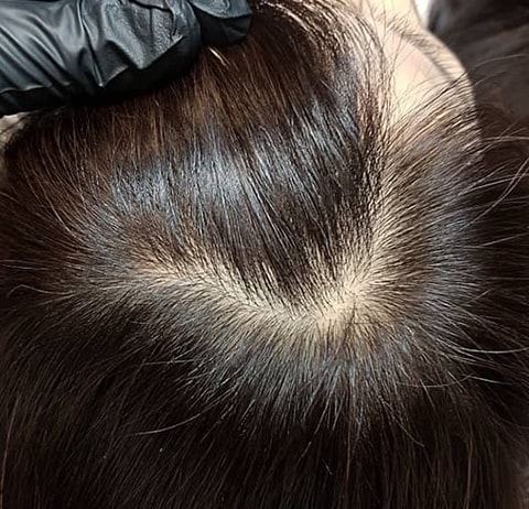 두피문신전