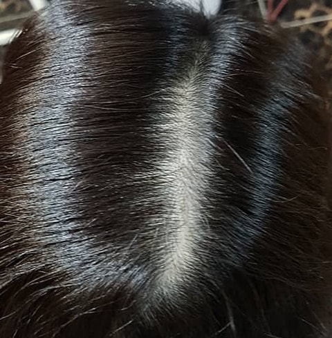 ㅎㄴㅂ 头皮纹身3个月后期