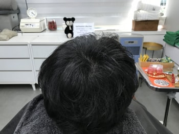 시술후 마른상태