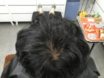 시술전 마른상태