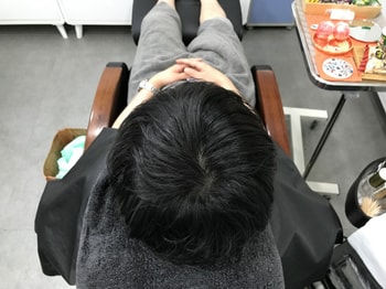 시술후 마른상태