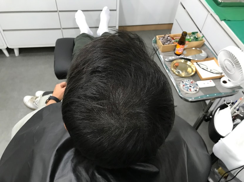 시술 후