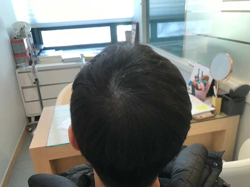 3년후