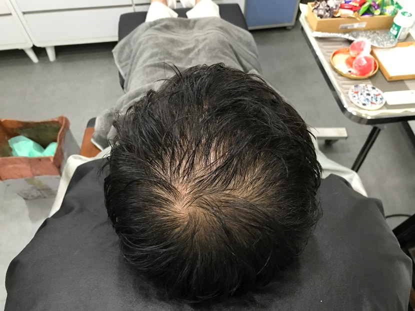 두피문신전 