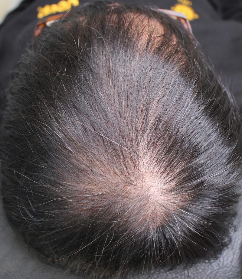 The scalp tattoo effect was so good that I even took my mom with me