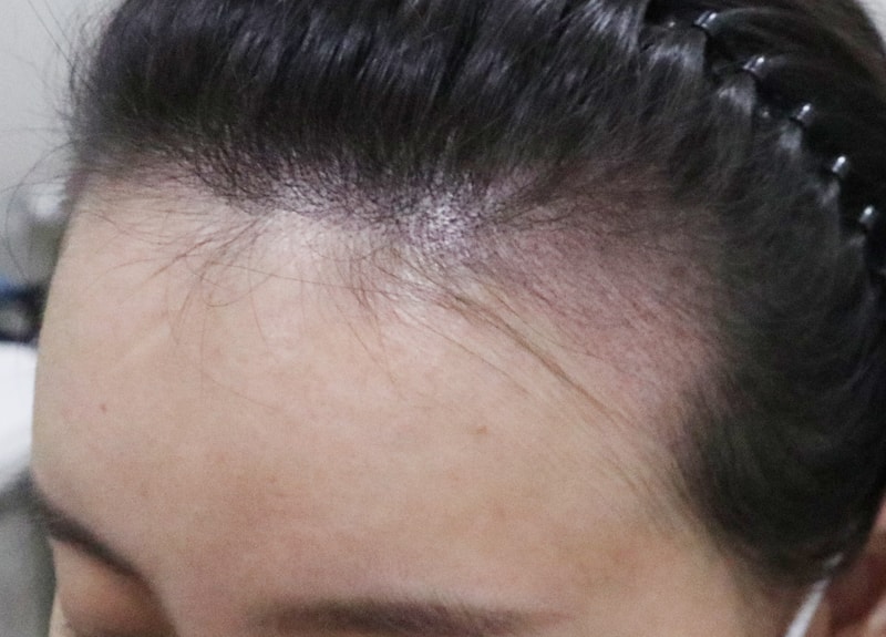 동생이 두피문신 받았는데 자연스럽게 잘 된 것 같아요
