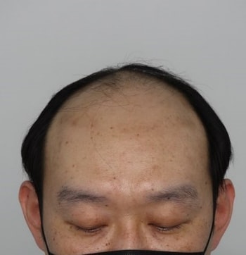 가발 벗었을때 입니다 발가벗은 기분이 드네요