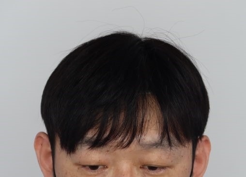 가발썻을때사진입니다