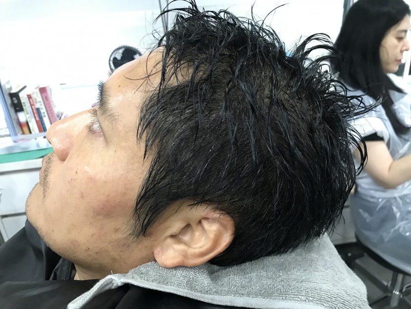 후