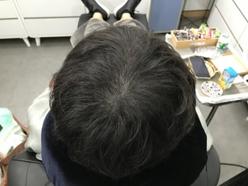 리터치 후 말린 머리