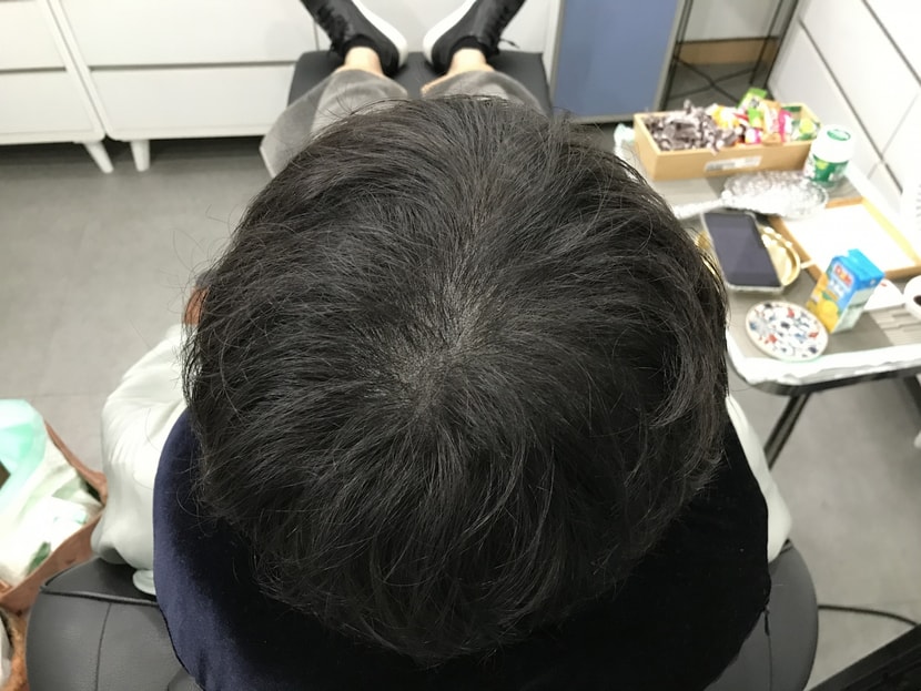 리터치 후 말린 머리