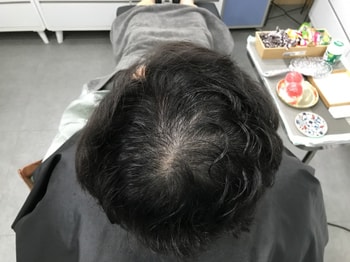 리터치 전 젖은머리