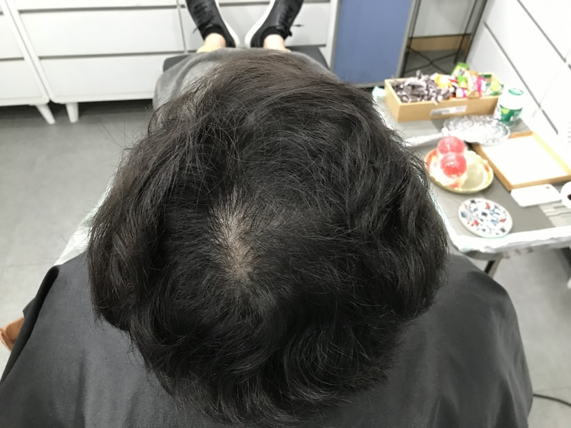 리터치 전 머리1