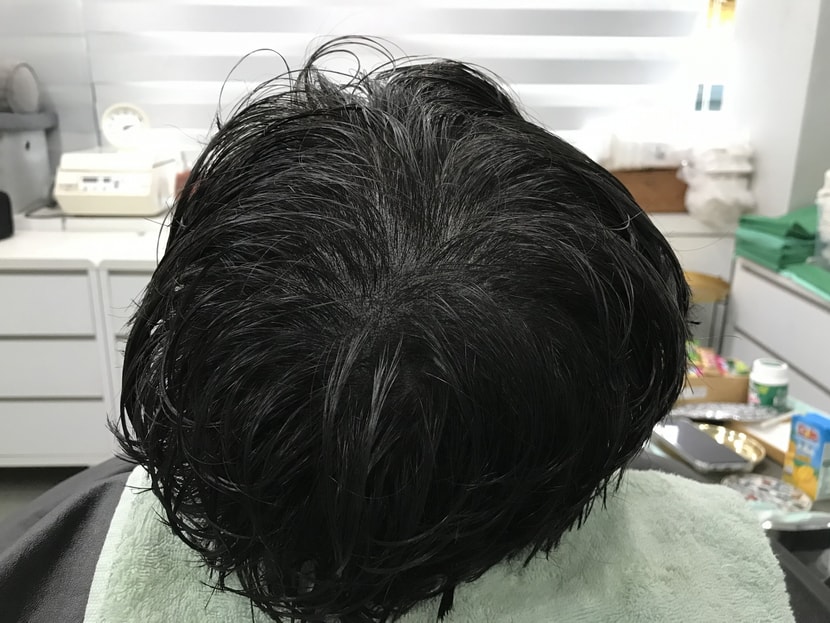 리터치 후 젖은머리