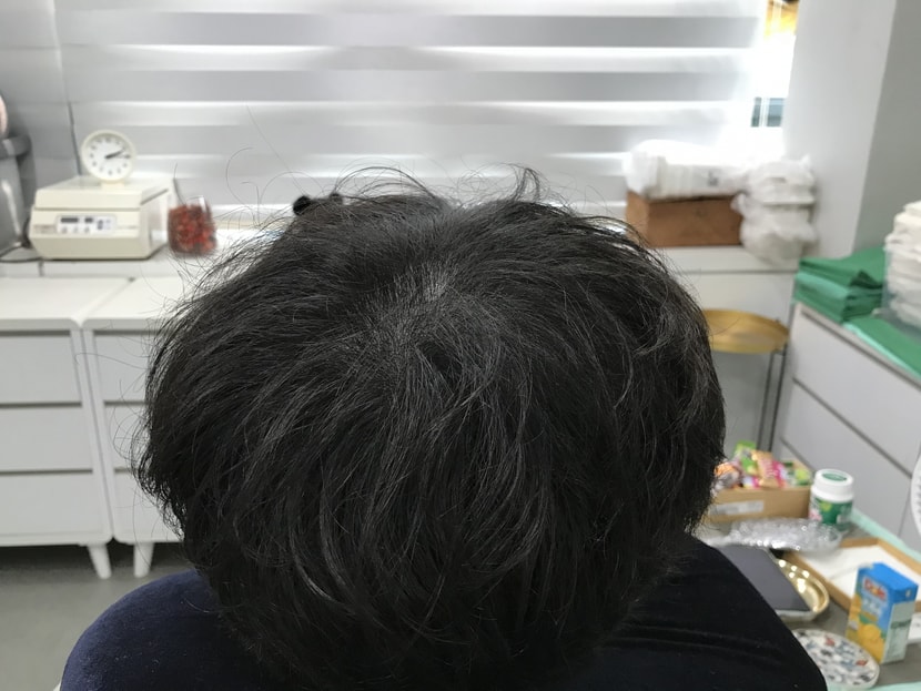 리터치 후 말린 머리2