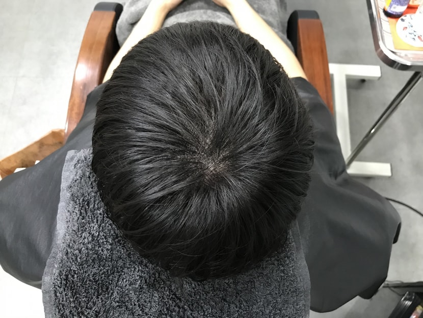 시술 후 마른 상태
