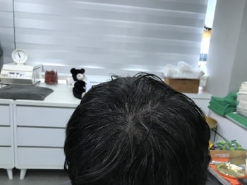 리터치 전 젖은상태