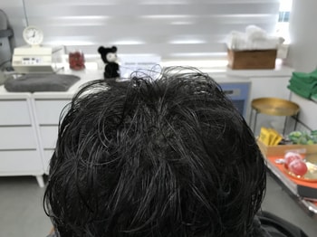 리터치 후 젖은상태