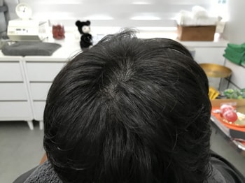 리터치 후 마른상태