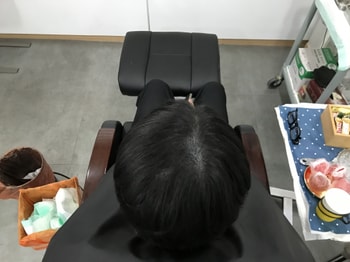 리터치 후