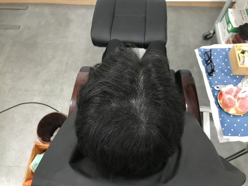 리터치 전