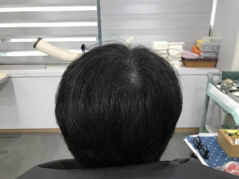 리터치 전