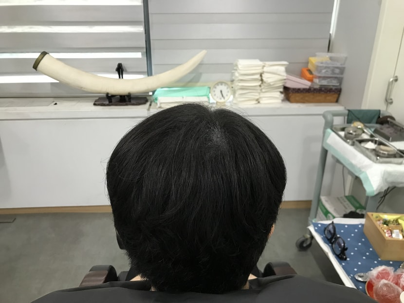 리터치 후