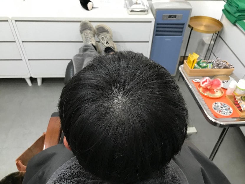 리터치후