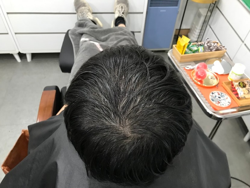 리터치전