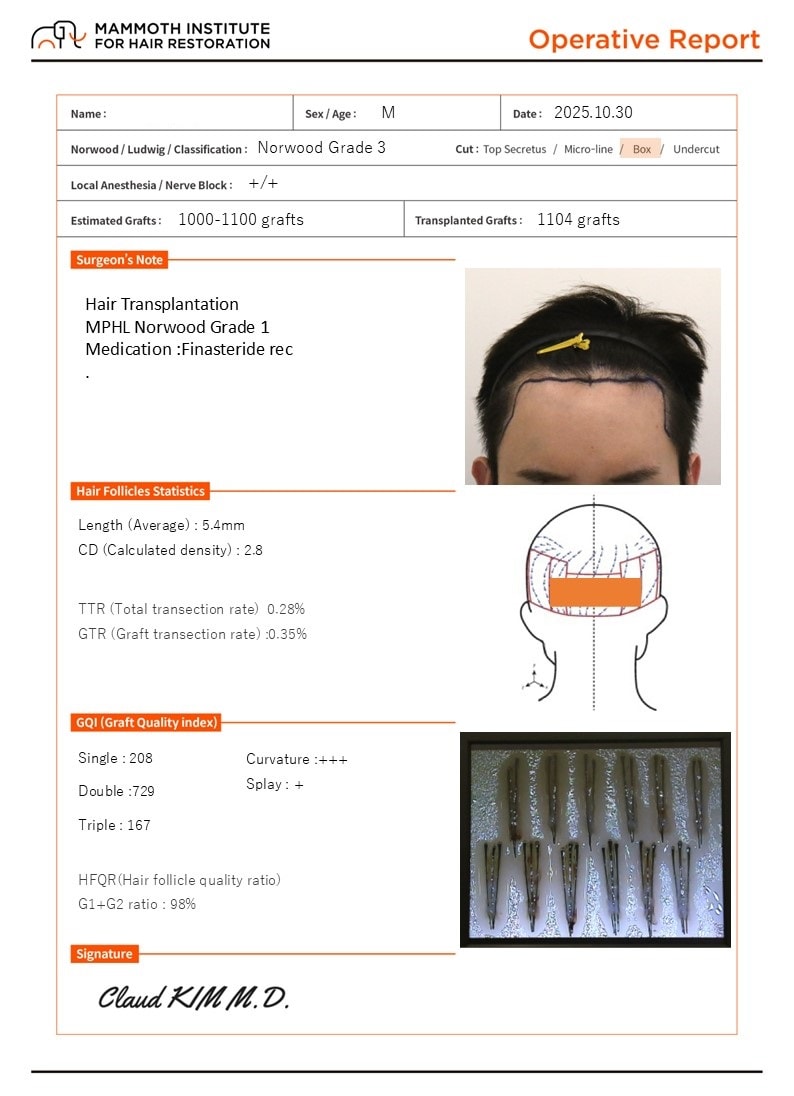 부산 맘모스 모발이식 슬릿방식 수술후기