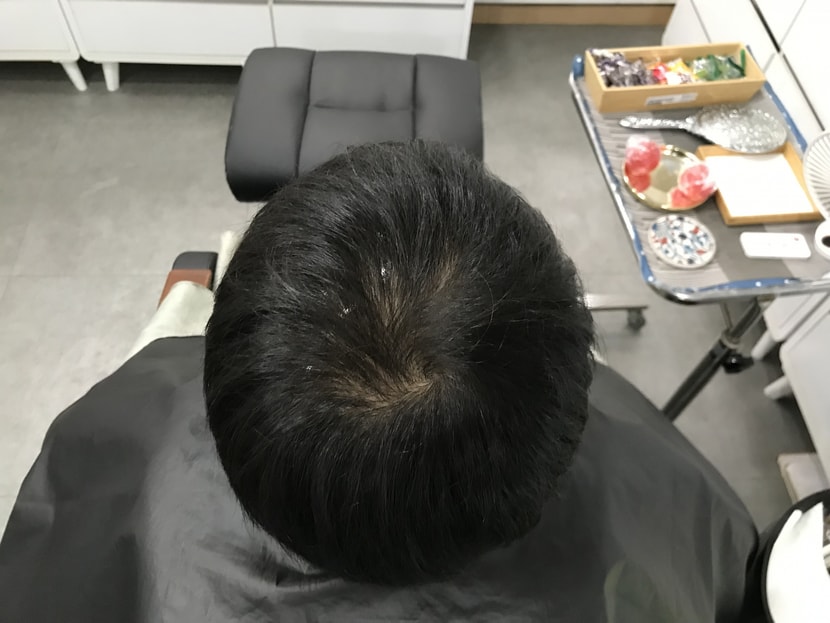 시술전