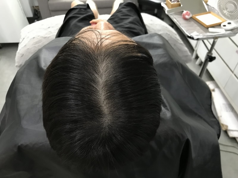 [YEONSEMI Dine]It's a review of scalp tattoos.
