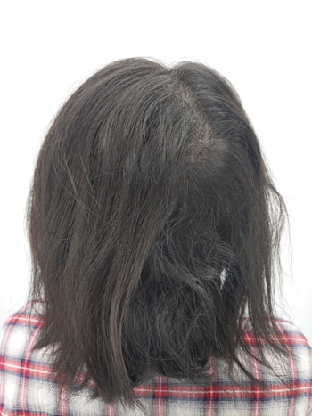처음사진이랑 오늘 마지막으로 끝내고 찍고 받은 사진이에요
