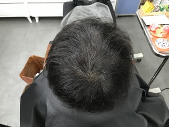 리터치 전