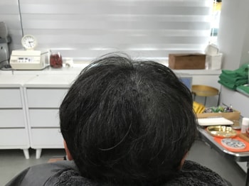리터치 후