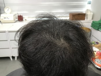 리터치 전