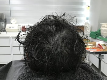 리터치 후
