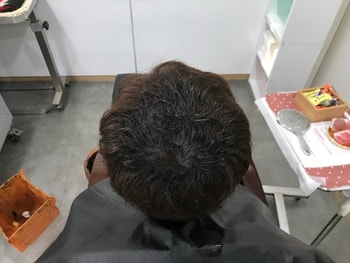 보강전