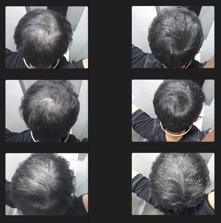 직접 찍은 사진 - 왼쪽 : before / 오른쪽 after