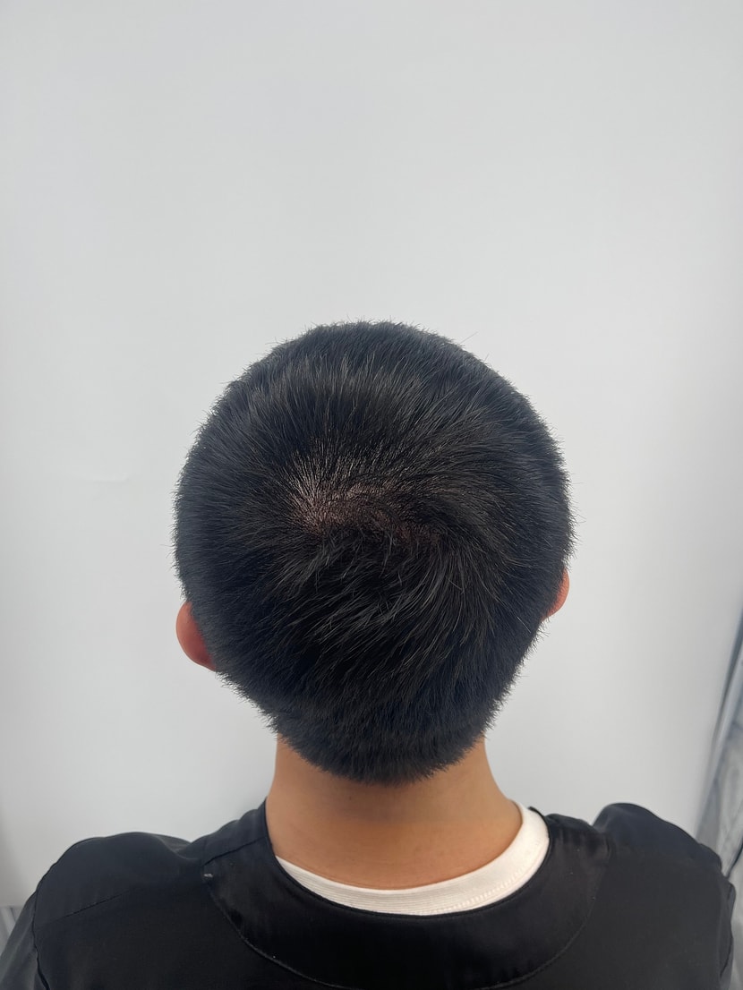 after