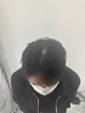 시술 후