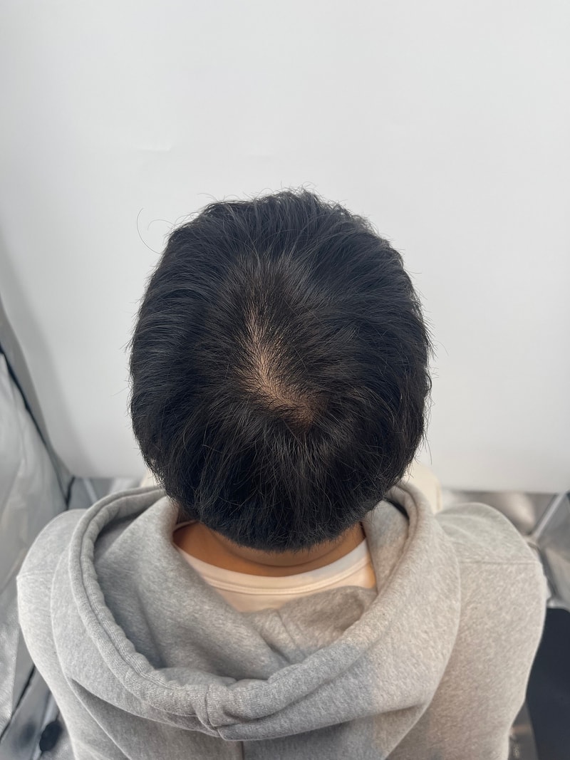 新发型 Smp 头皮纹身头顶
