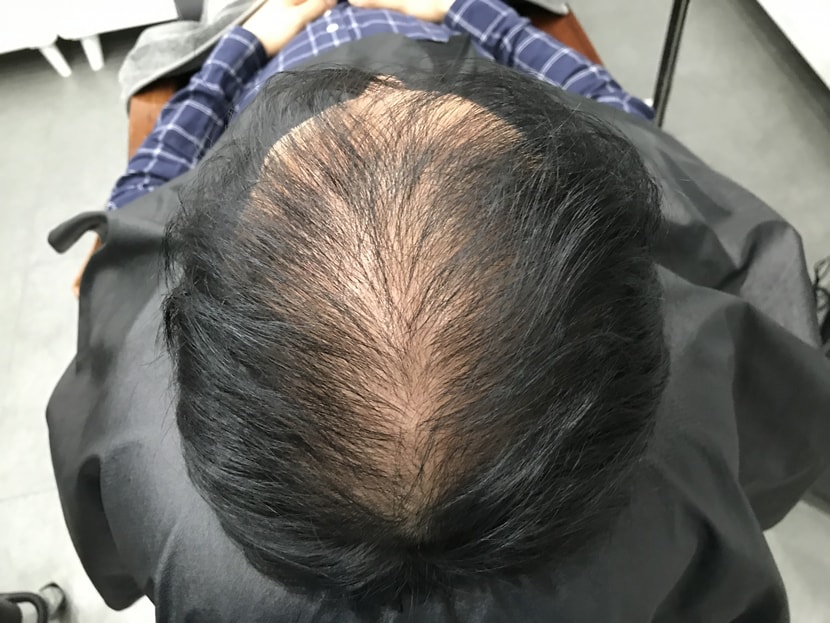 두피문신전 사진1