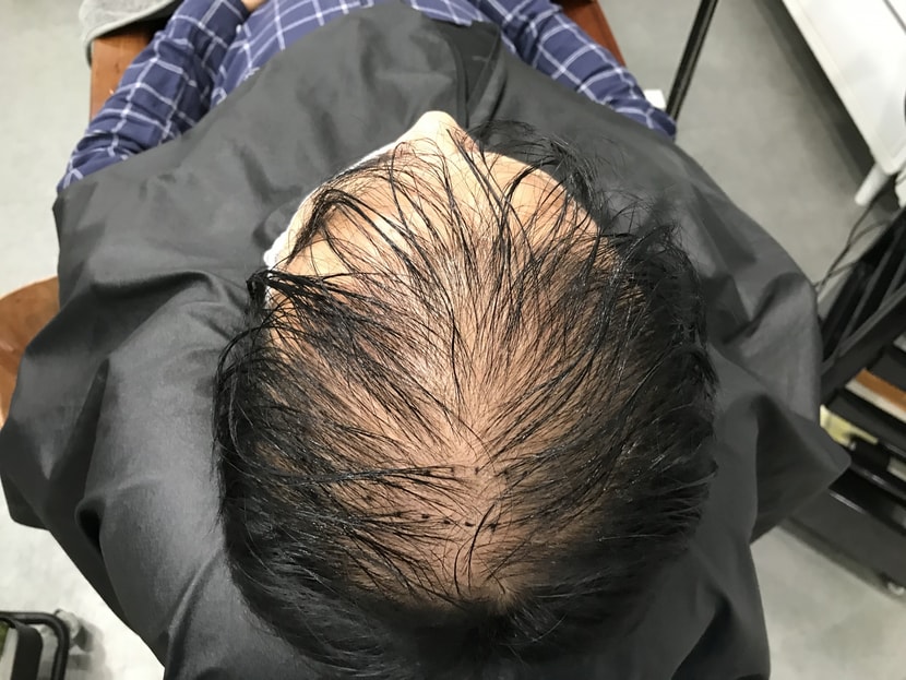 두피문신전 사진2